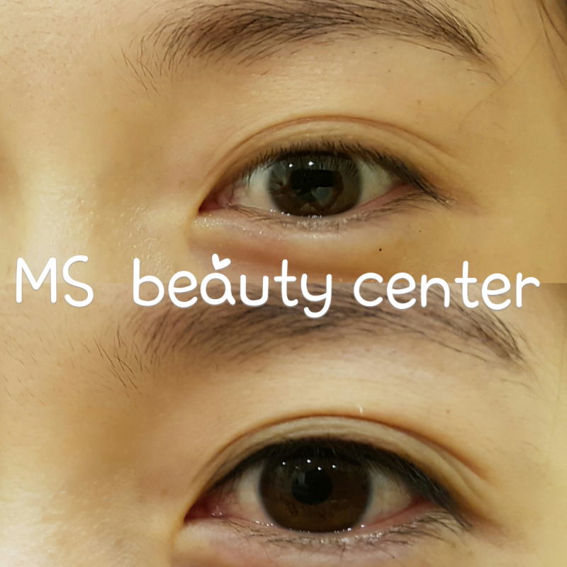 디너의여왕 - [강남] MS beauty - 피부관리